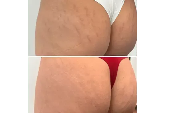 a close up of a woman's buttocks