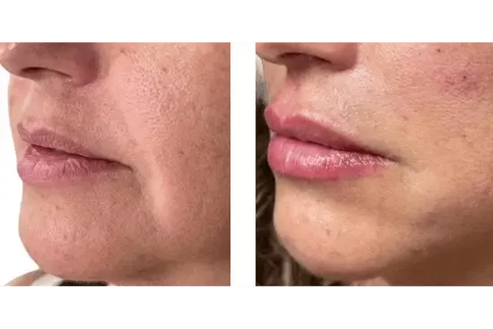 a close up of a woman's face