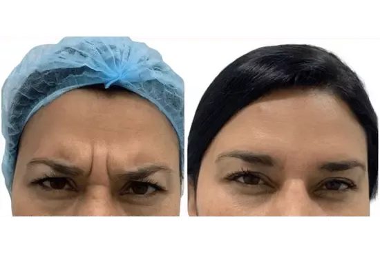 a close up of a woman's face