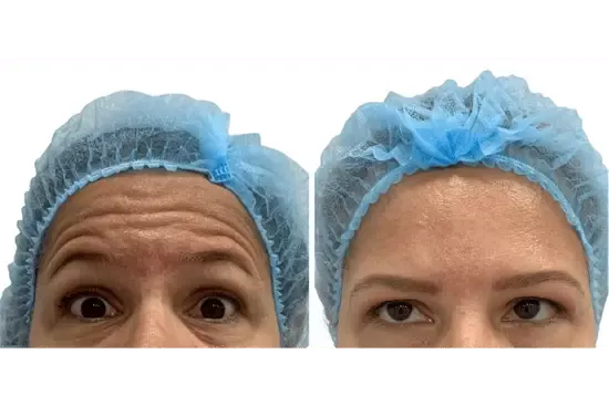 a collage of a woman's face with a blue cap