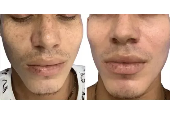 a collage of a man's face