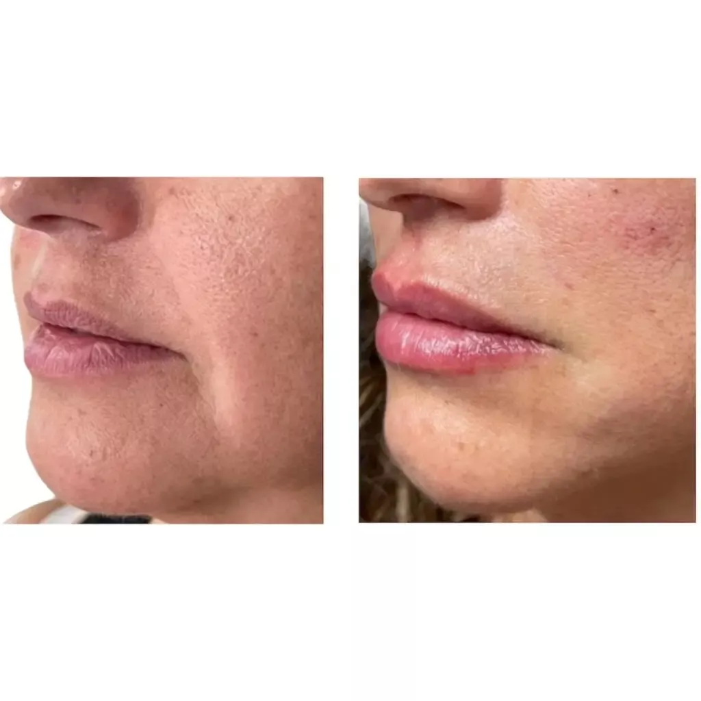 a close up of a woman's face