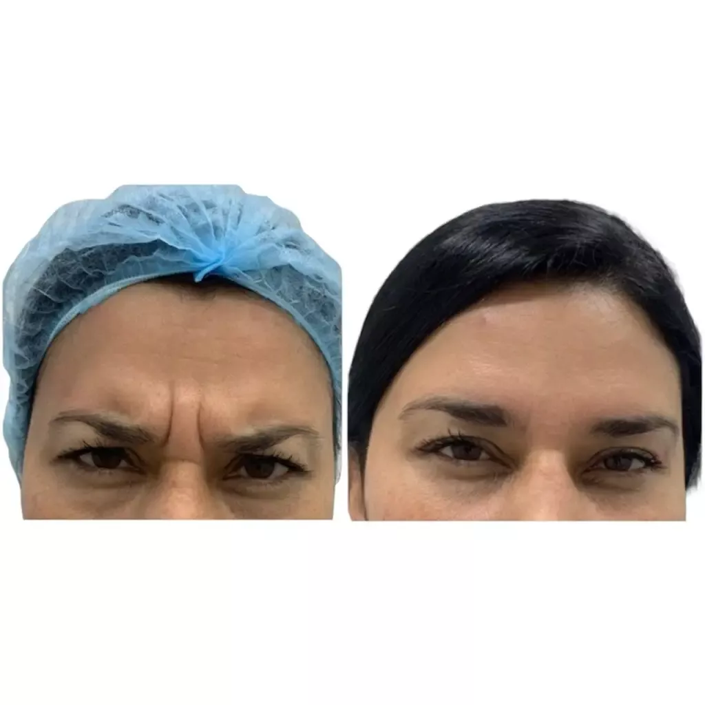 a close up of a woman's face