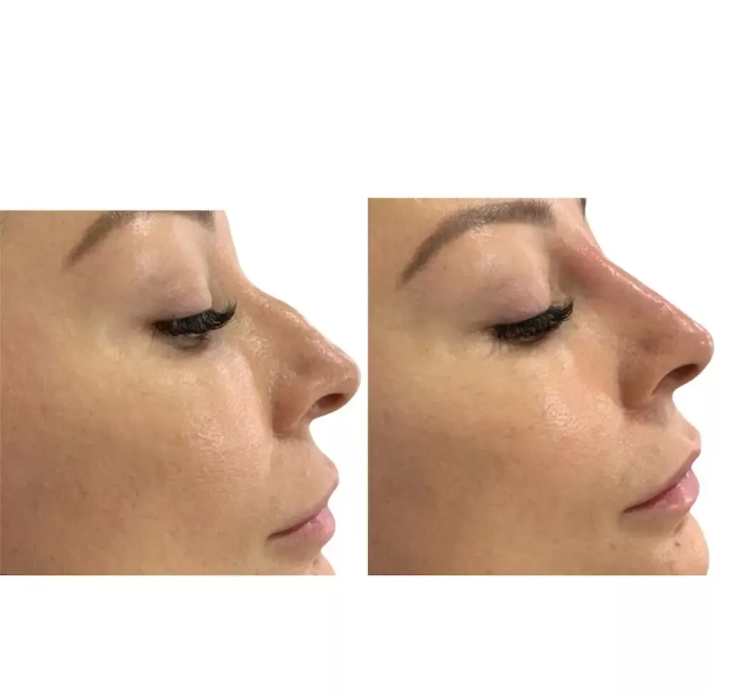 a close up of a woman's face