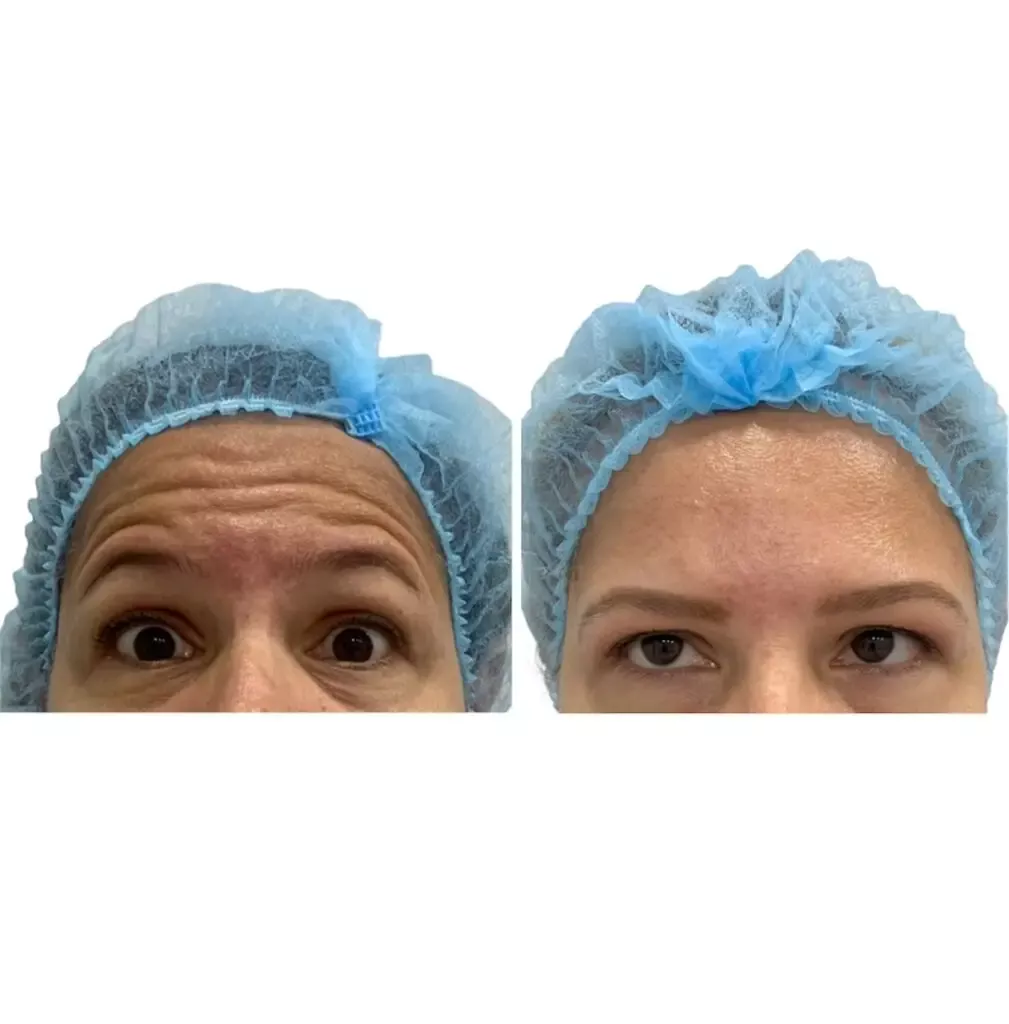 a woman with blue hair net