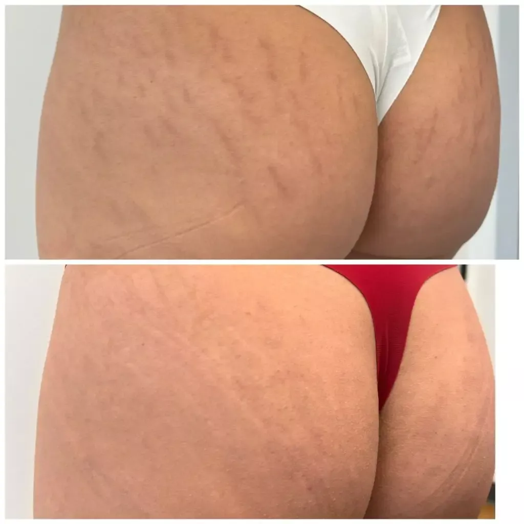 a close up of a woman's buttocks