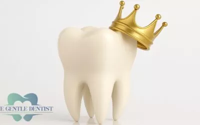 Filling or Crown: How Dentists Decide (and What It Means for You)