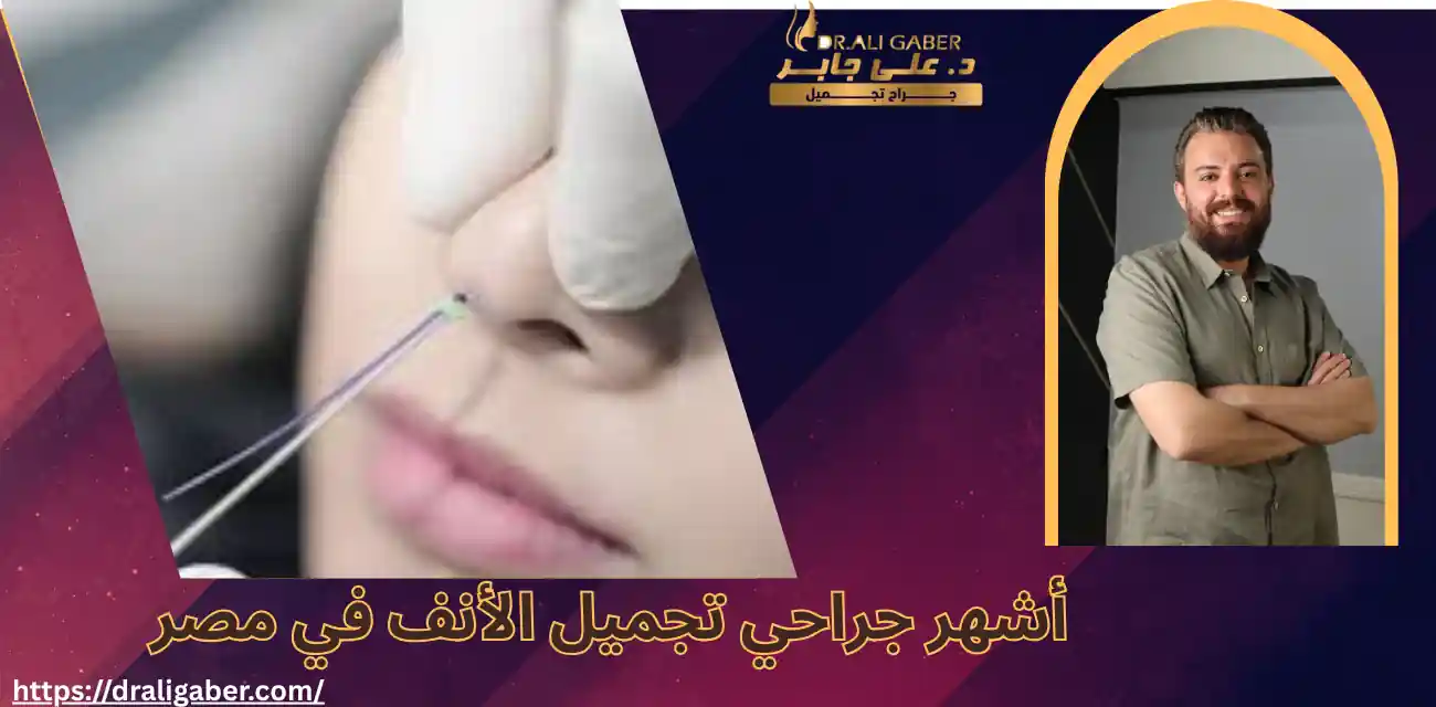 افضل جراح تجميل انف في مصر