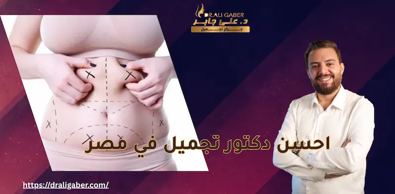 احسن دكتور تجميل في مصر