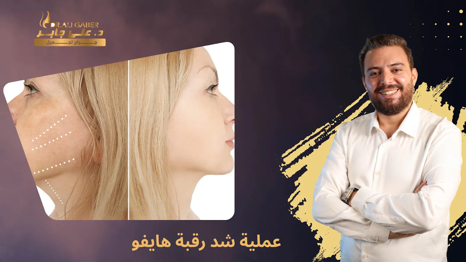 شد رقبة هايفو