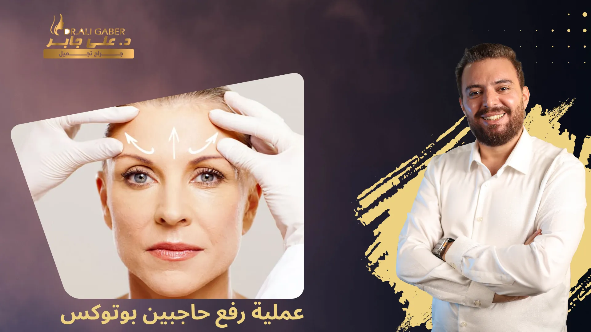 رفع حاجبين بوتوكس