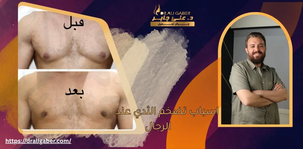 تضخم الثدي عند الرجال