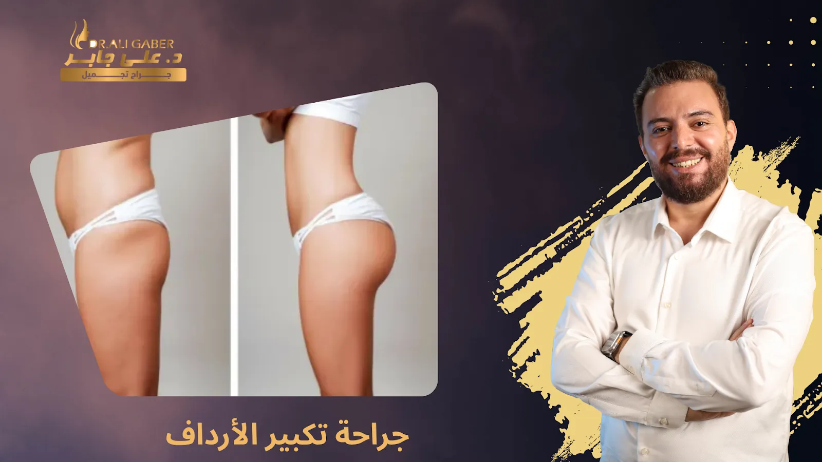 جراحة تكبير الأرداف