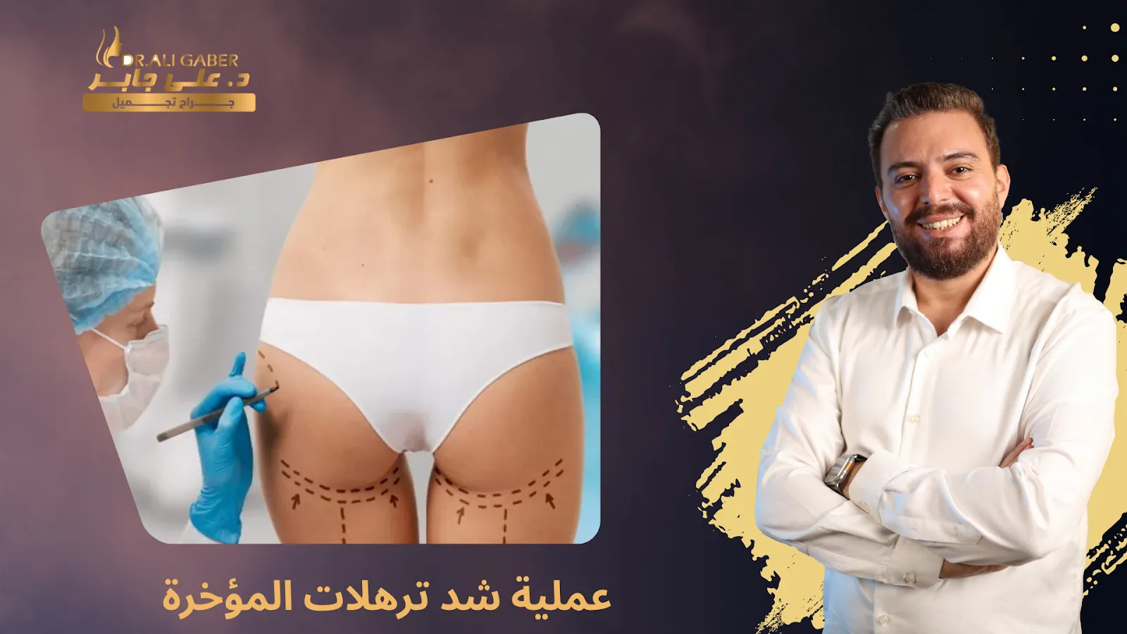 شد ترهلات المؤخرة