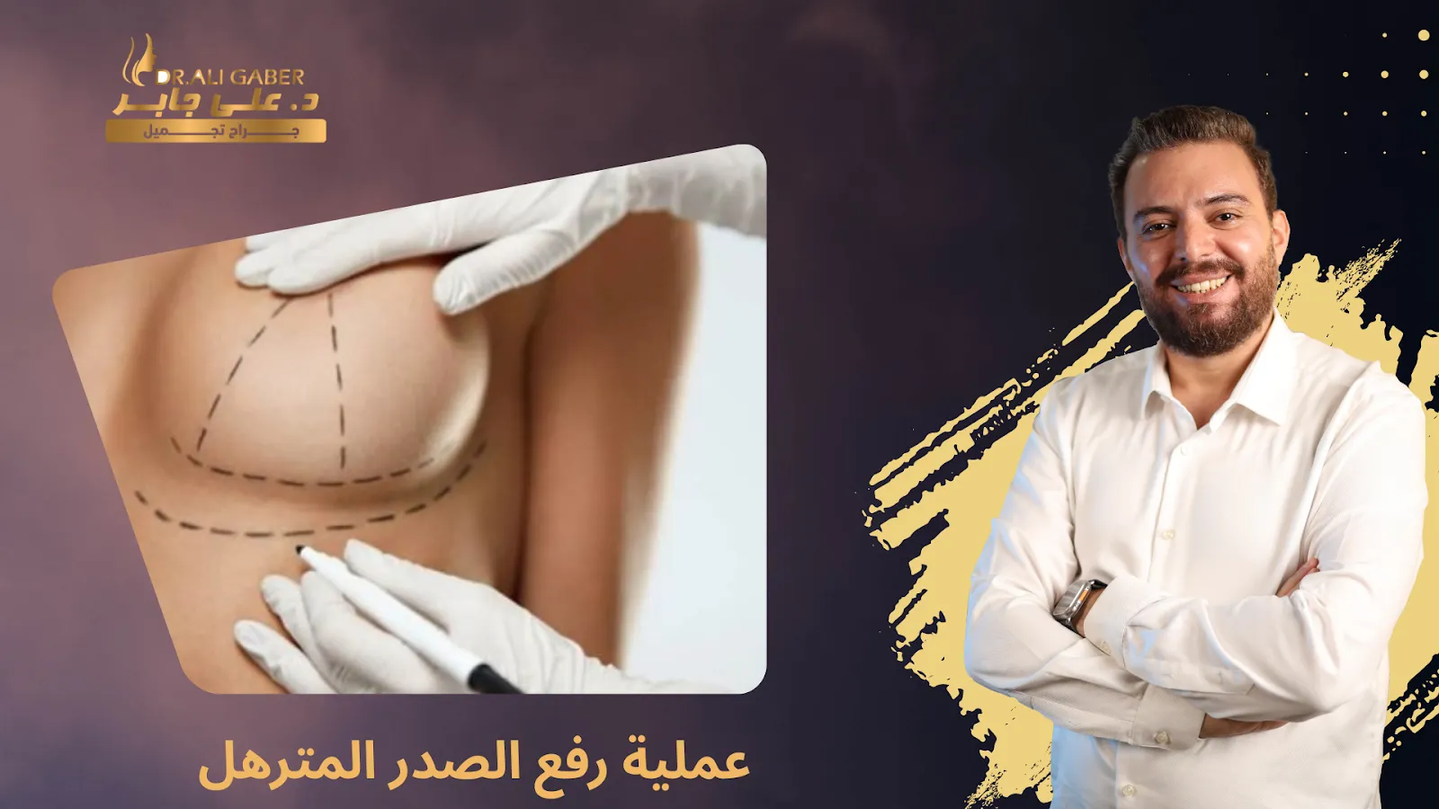 رفع الصدر المترهل