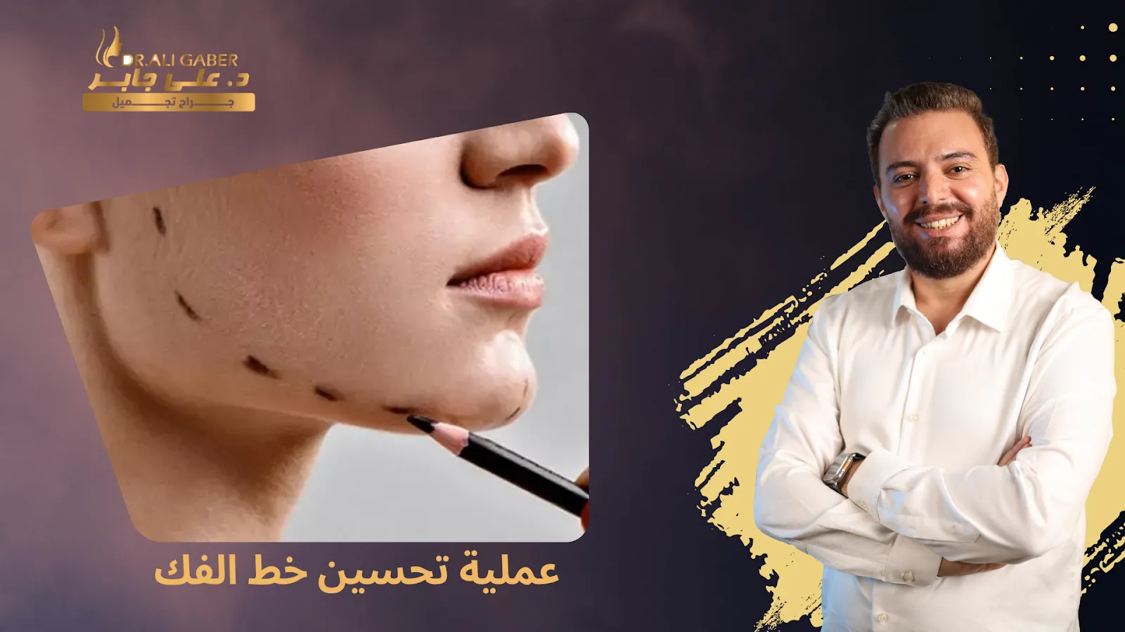 تحسين خط الفك