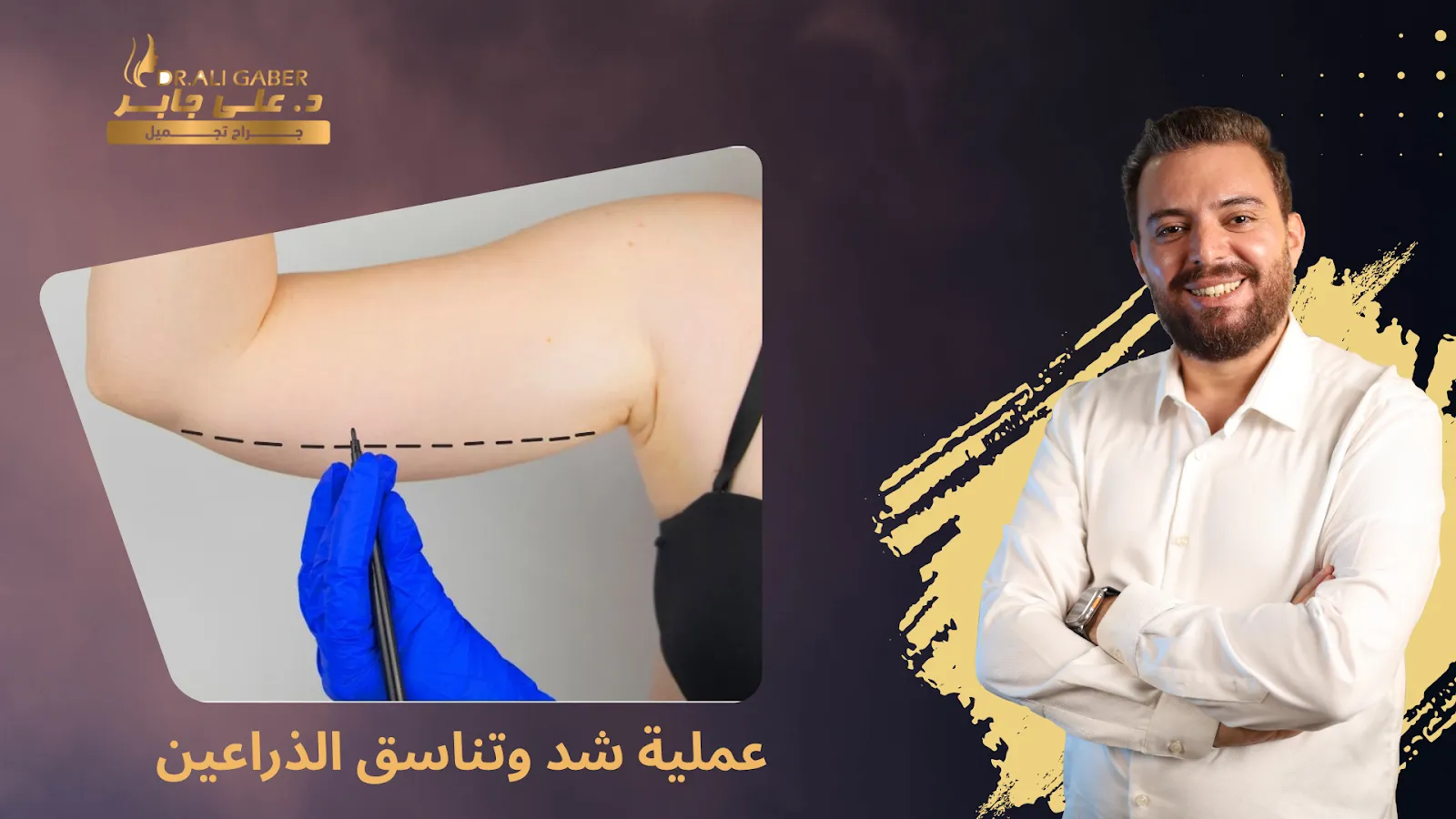 شد وتناسق الذراعين