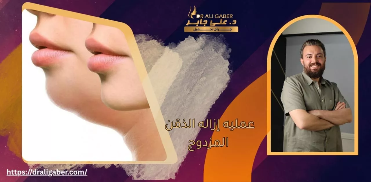 إزالة الذقن المزدوج