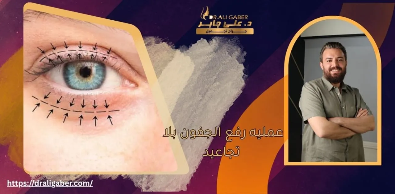 رفع الجفون