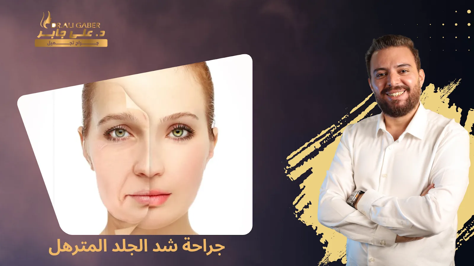 جراحة شد الجلد المترهل