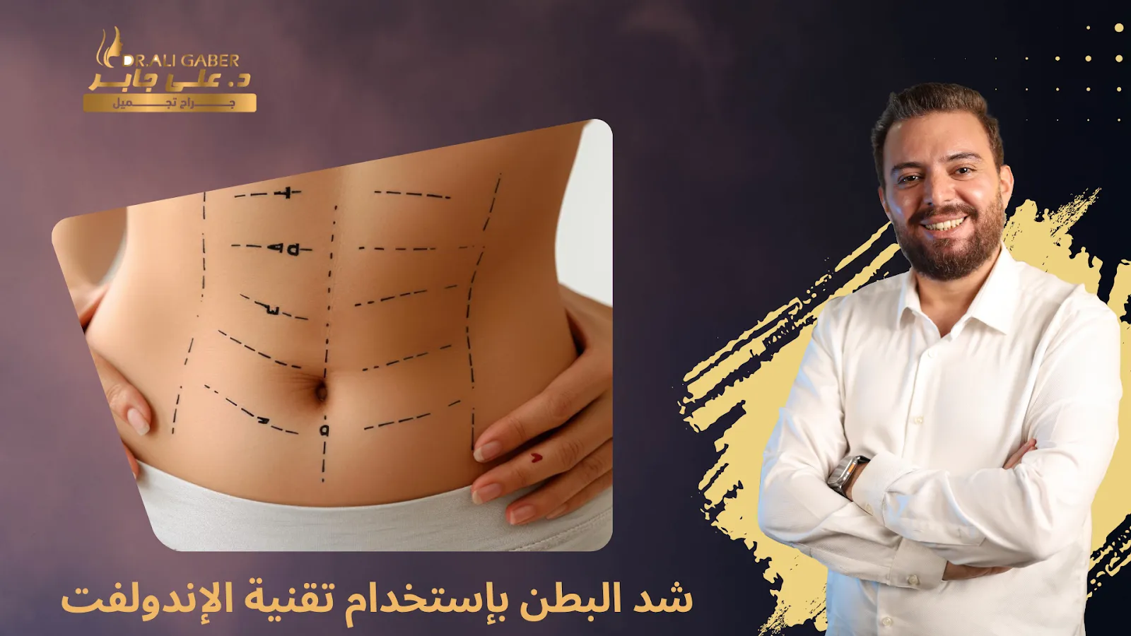 تقنية الإندولفت