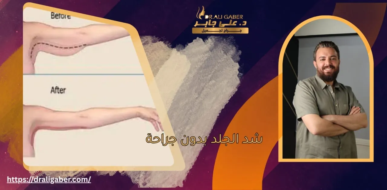 شد الجلد بدون جراحة
