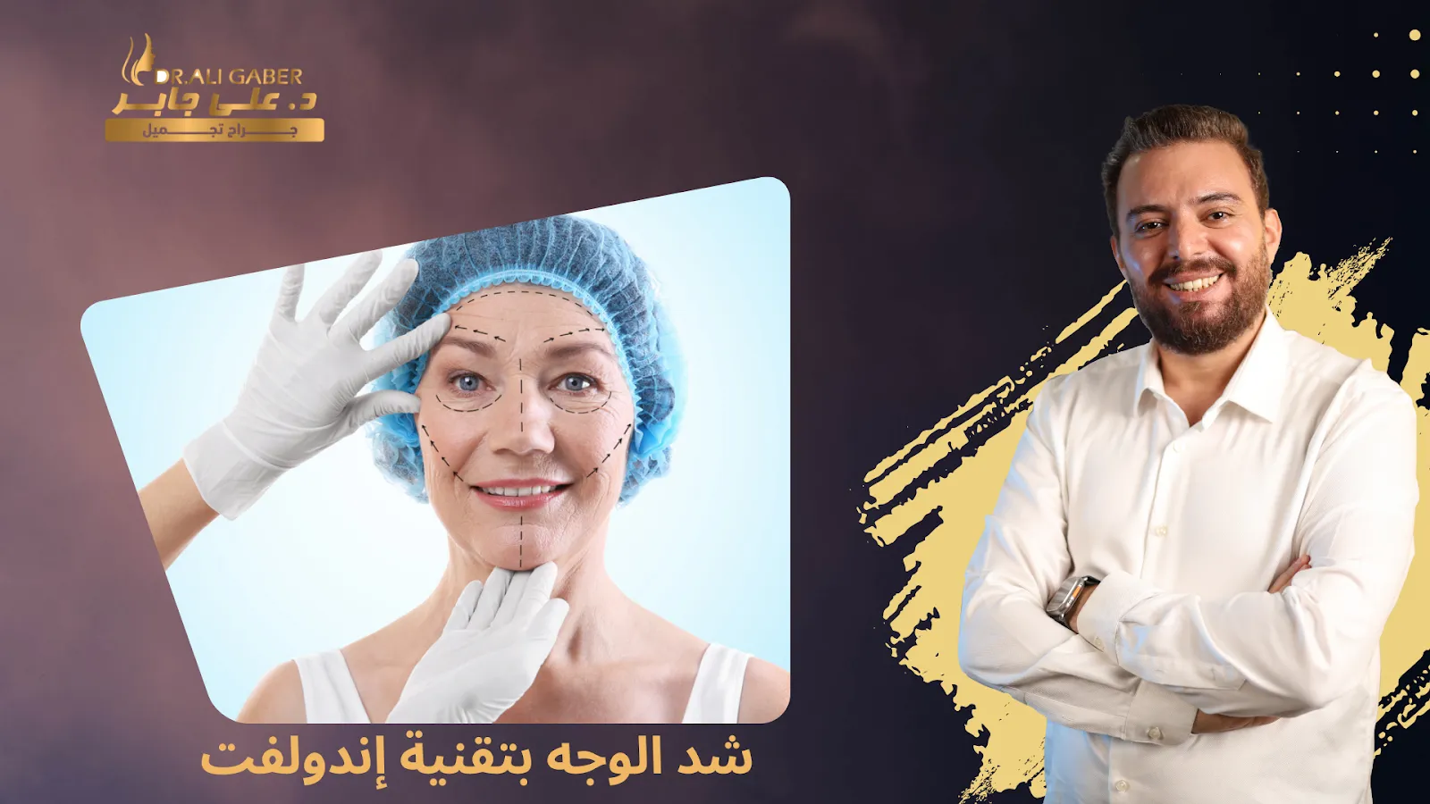 تقنية إندولفت