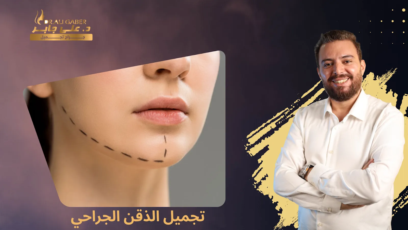 تجميل الذقن الجراحي