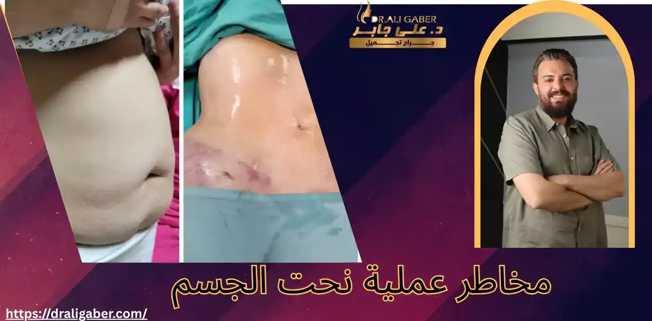 افضل دكتور نحت الجسم في مصر