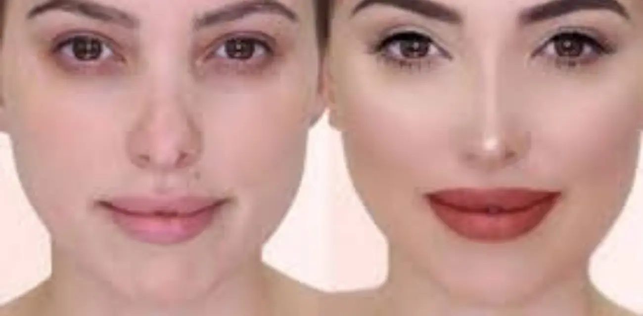 تكلفة عملية تجميل الانف في مصر