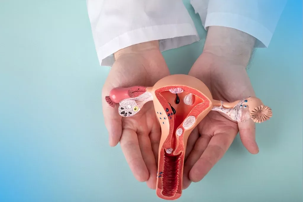 عملية تضييق المهبل بالليزر