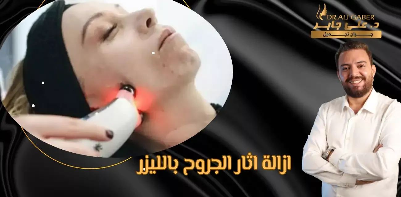 سعر عملية تجميل الجروح