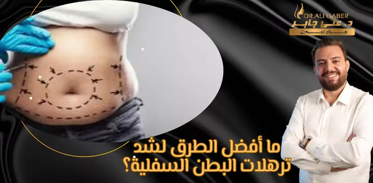 شد ترهلات البطن السفلية