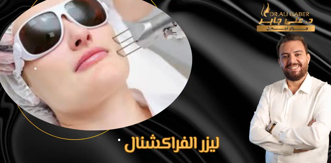 تجربتي مع ليزر الفراكشنال