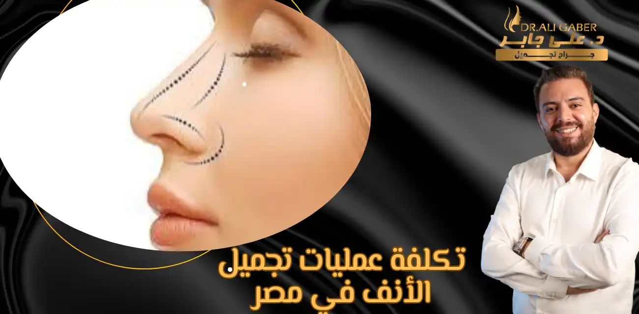 افضل دكتور تجميل انف في مصر