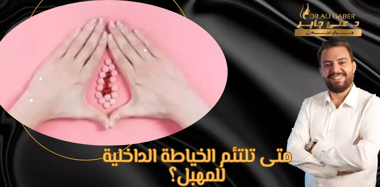 خياطة المهبل من الداخل