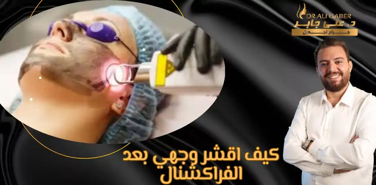 متى اغسل وجهي بعد الفراكشنال