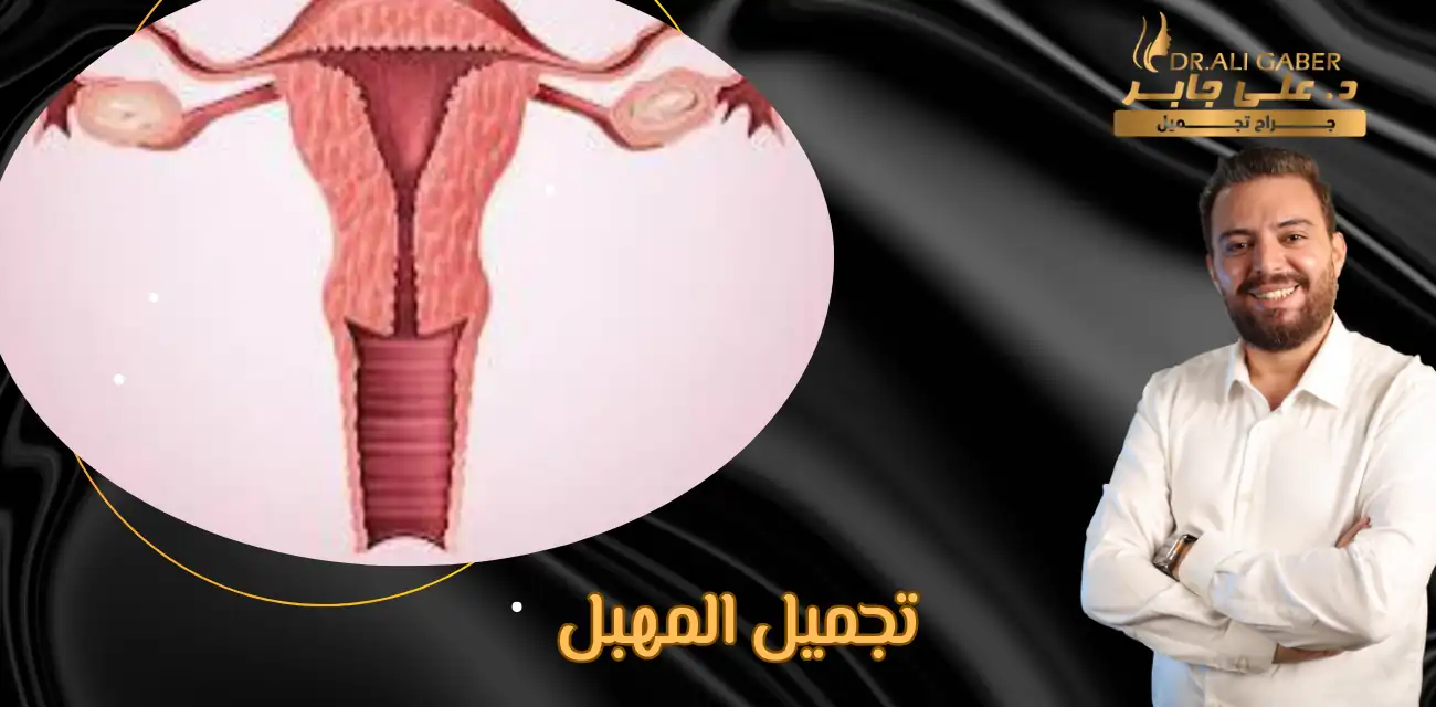 تجميل المهبل