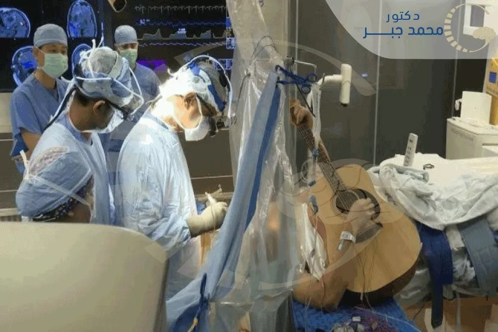 جراحة المخ أثناء اليقظة (Awake Craniotomy)