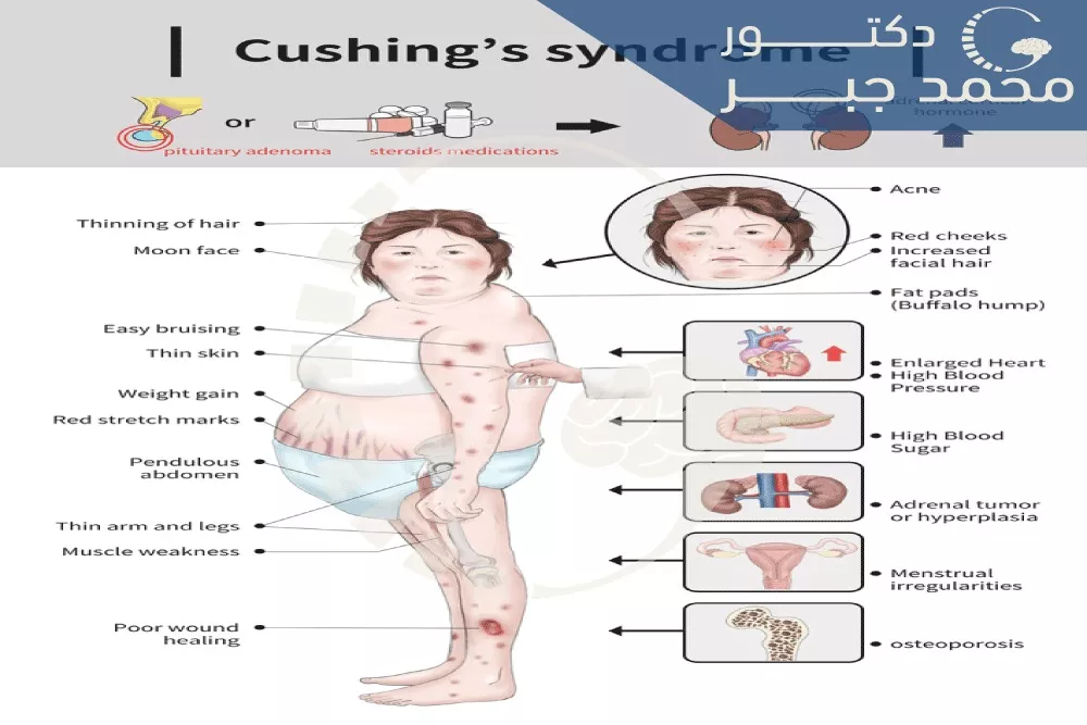 ุงูุบุฏุฉ ุงููุฎุงู
ูุฉ ูุงููุฒู