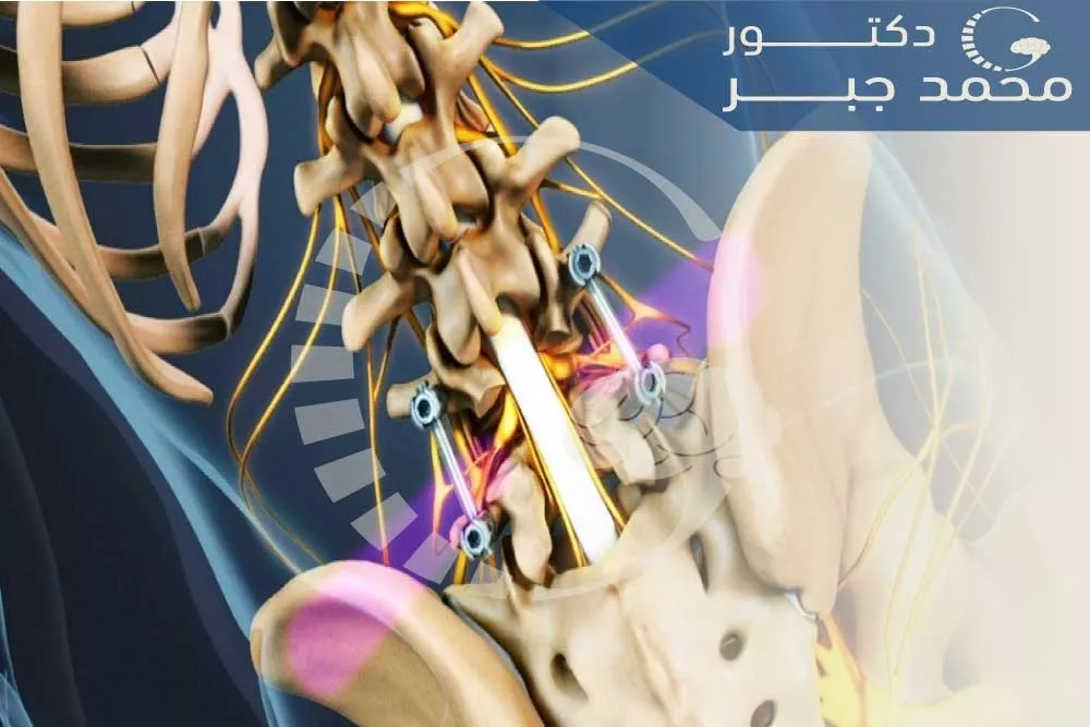 ุนู
ููุฉ ุชุซุจูุช ุงูููุฑุงุช ุจุงูุดุฑุงุฆุญ ูุงูู
ุณุงู
ูุฑ