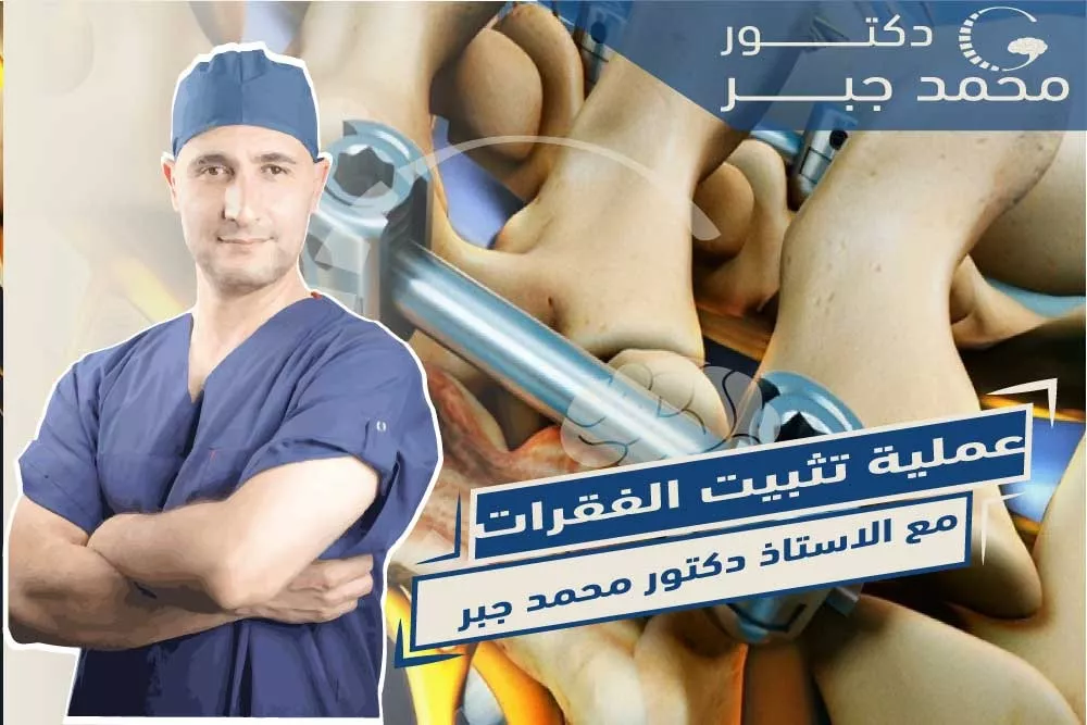 ุนู
ููุฉ ุชุซุจูุช ุงูููุฑุงุช ุจุงูุดุฑุงุฆุญ ูุงูู
ุณุงู
ูุฑ