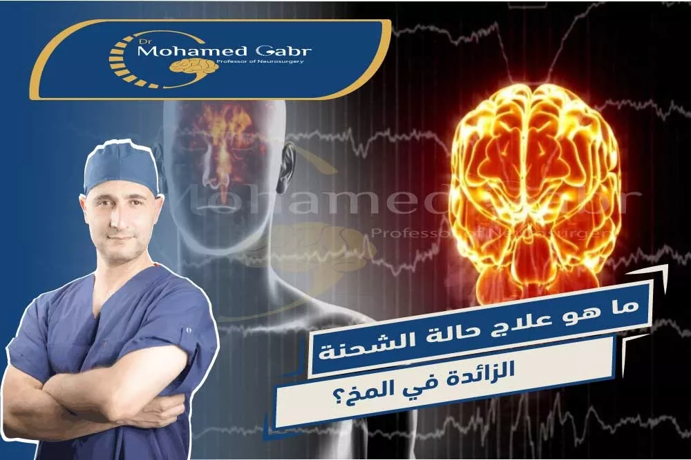 ููููุฉ ุนูุงุฌ ุงูููุฑุจุงุก ุงูุฒุงุฆุฏุฉ ูู ุงูู
ุฎ