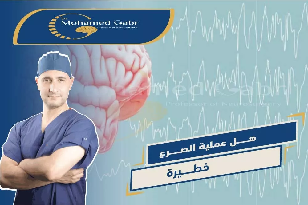 افضل دكتور لعلاج الصرع