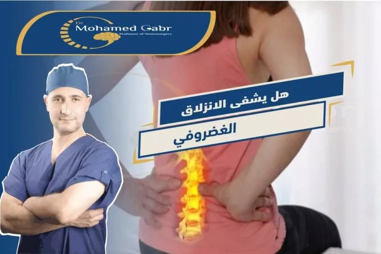 ูู ูุดูู ุงูุงูุฒูุงู ุงูุบุถุฑููู