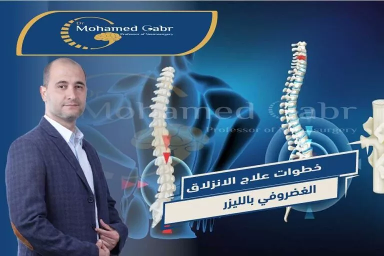 ุนู
ููุฉ ุงูุบุถุฑูู ุจุงูููุฒุฑ ูู ู
ุตุฑ