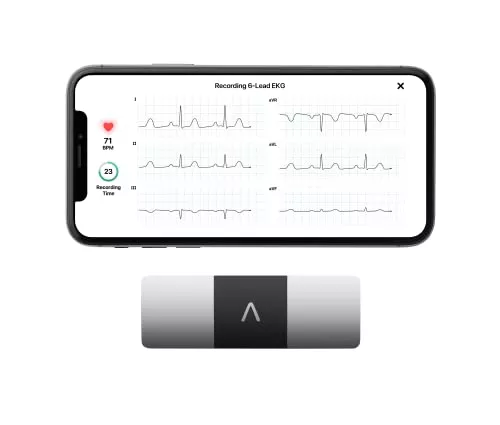 Home 32 KardiaMobile 6-Lead Personal EKG Monitor – Six Views of The Heart – Detects AFib and Irregular Arrhythmias – Instant Results in 30 Seconds – Works with Most Smartphones - FSA/HSA Eligible