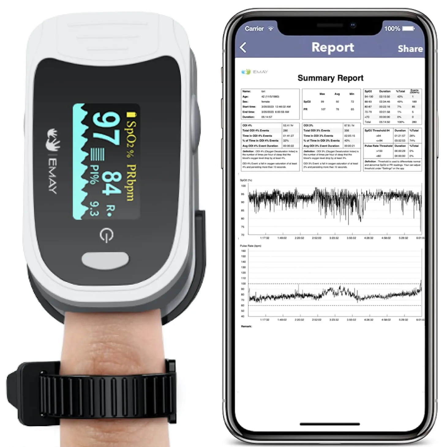 Overnight Oximeter: Top 5 Devices for Sleep Monitoring in 2024 2 Overnight Oximeter: Top 5 Devices for Sleep Monitoring in 2024 blood oxygen