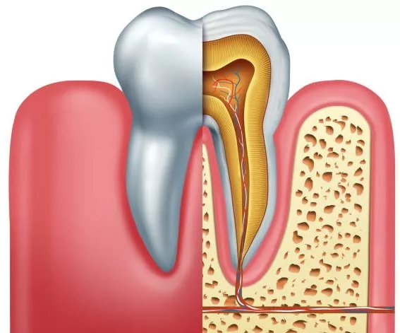 Tooth with Rootย Canal Hurts with Pressure: Months and Years Later