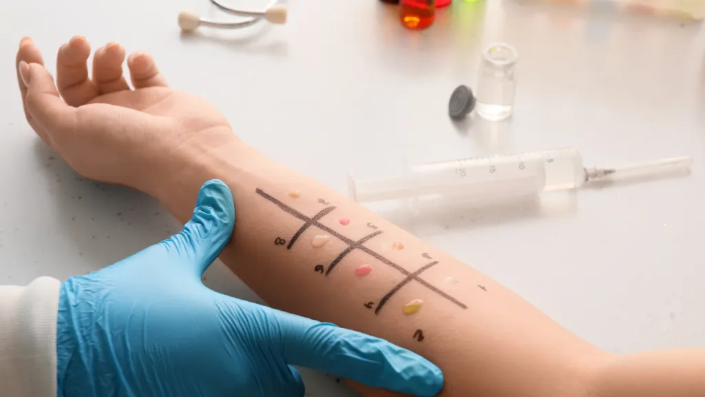 Allergy and Asthma Testing